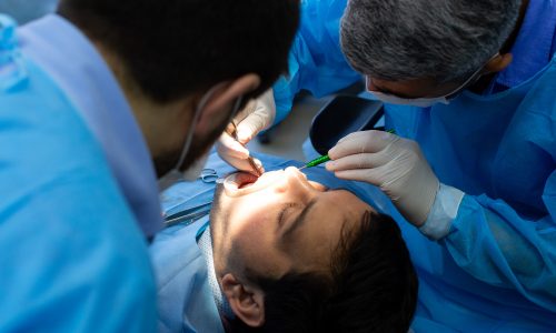 Tooth Extraction